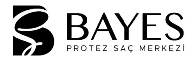 Bayes Protez Saç Uygulama